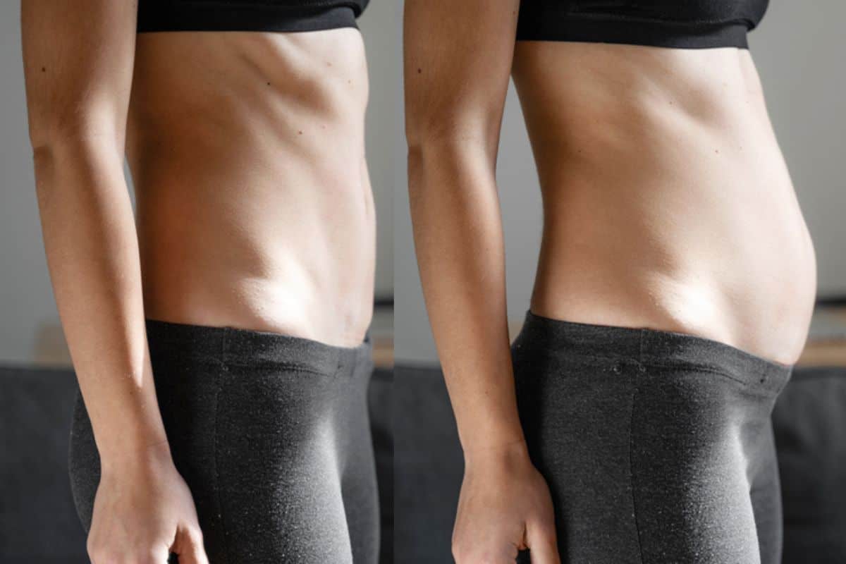 How long does diastasis recti take to improve Ledbury?