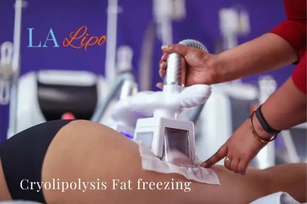 women getting fat freezing Ledbury
