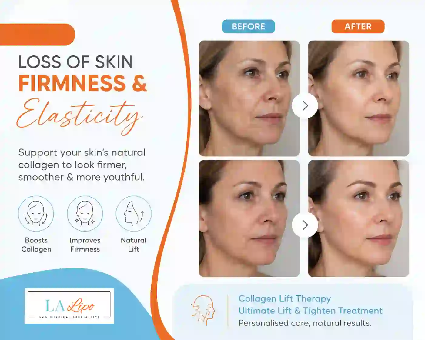 Sign #7: Loss of Skin Firmness and Elasticity Ledbury