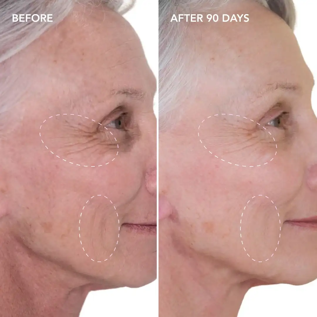When will you see results Ledbury